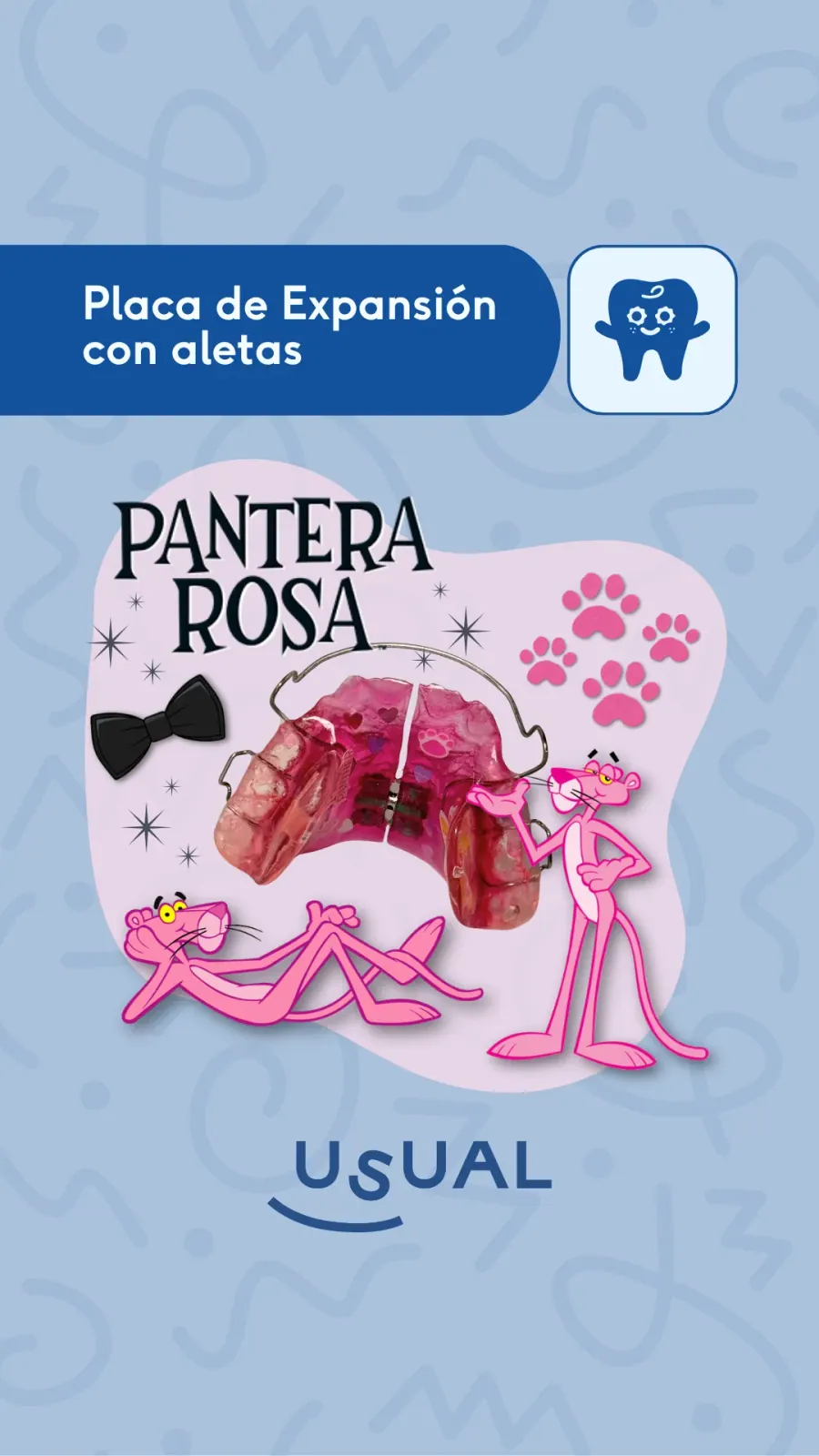 Portada de reel Usual Dental Lab · 'Placa de expansión con aletas' edición Pantera Rosa