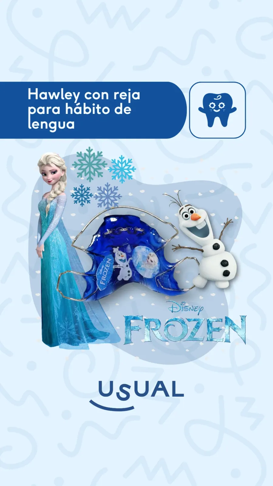 Portada de reel Usual Dental Lab · 'Hawley con reja para hábito de lengua' edición Frozen